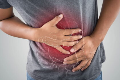 Alimentos que soltam o intestino e aliviam a prisão de ventre naturalmente